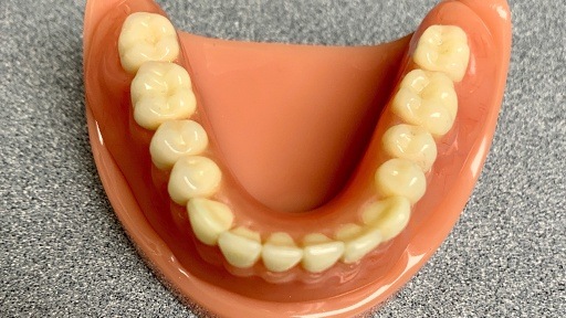 Full dentures on smile model
